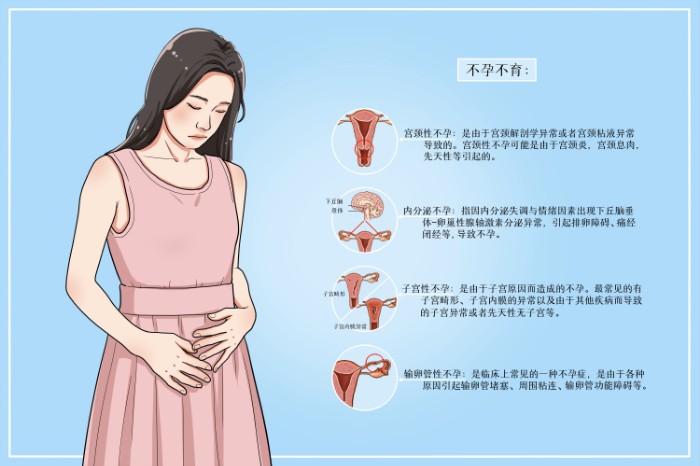 攝圖網(wǎng)_401961514_女性不孕不育醫(yī)療插畫（非企業(yè)商用）.jpg